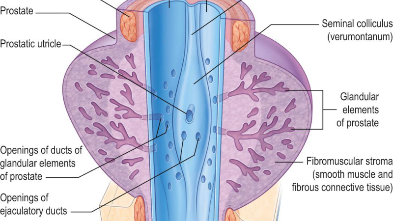 prostate gland cross-section illustration with inflammation markers