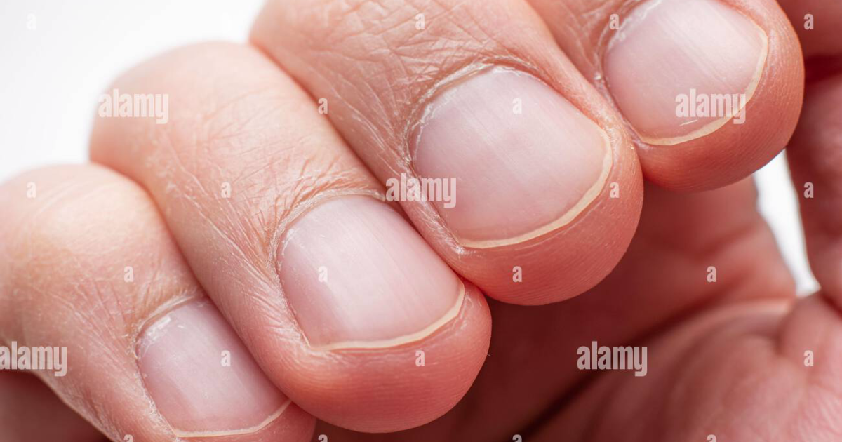 Fungus Elixir: De diepgaande fysiologische mechanismen voor optimale nagelgezondheid