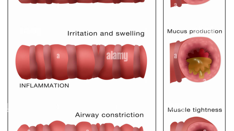 cross-section of constricted vs. dilated bronchiole