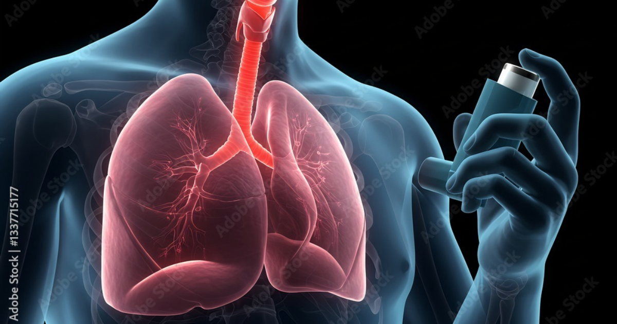 Breathe: Why Inhaled Corticosteroids May Increase Pneumonia Risk in COPD Patients