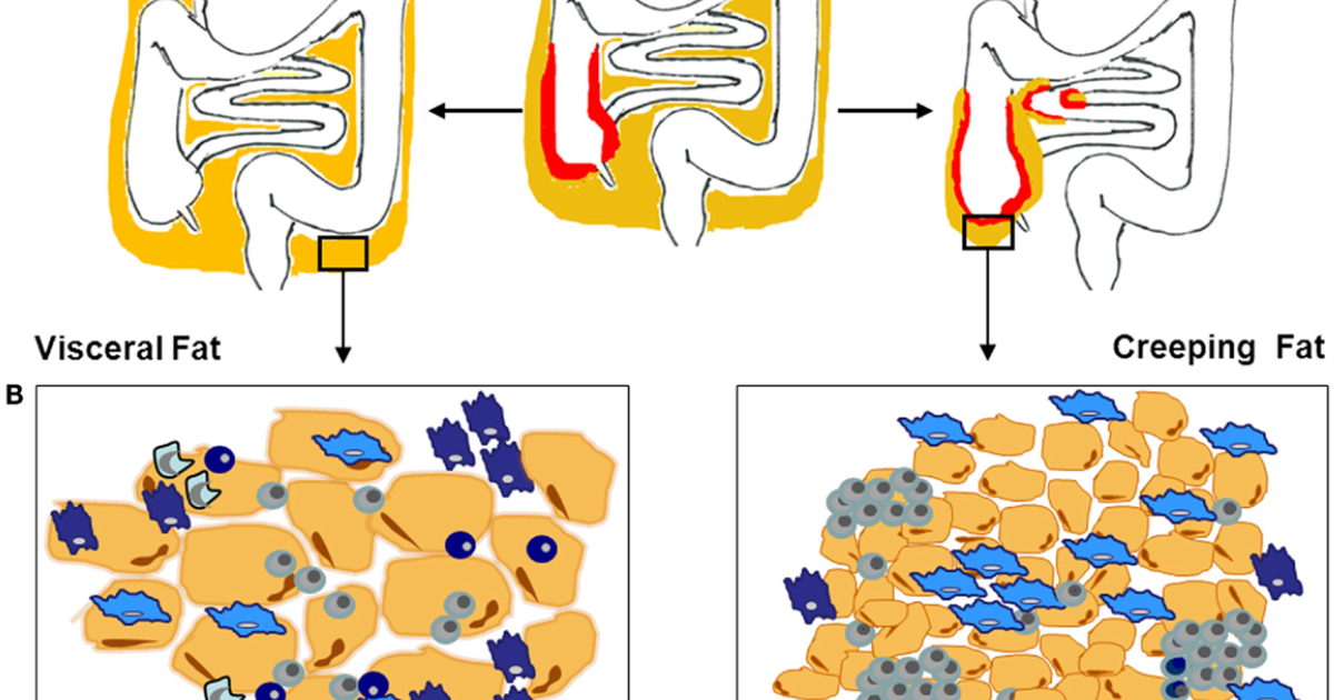 21KETO Gummies: Breaking the Visceral Fat-Inflammation Cycle for Sustainable Weight Loss