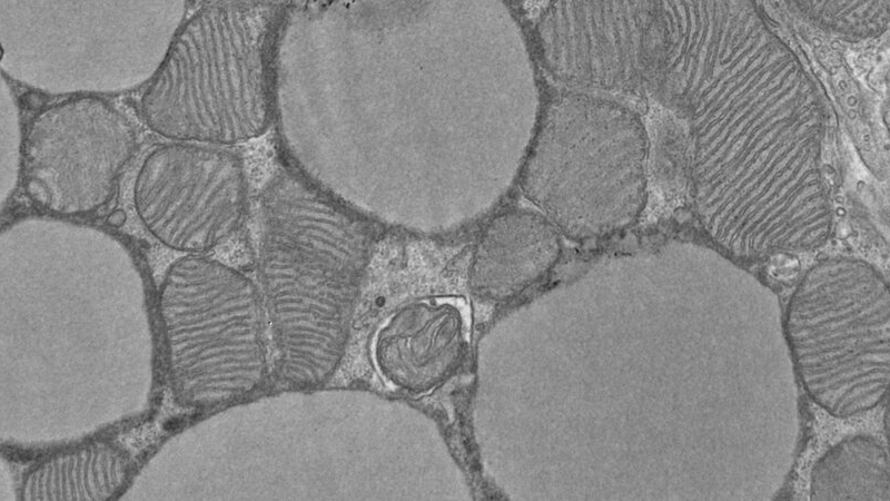 brown adipose tissue mitochondria electron microscopy