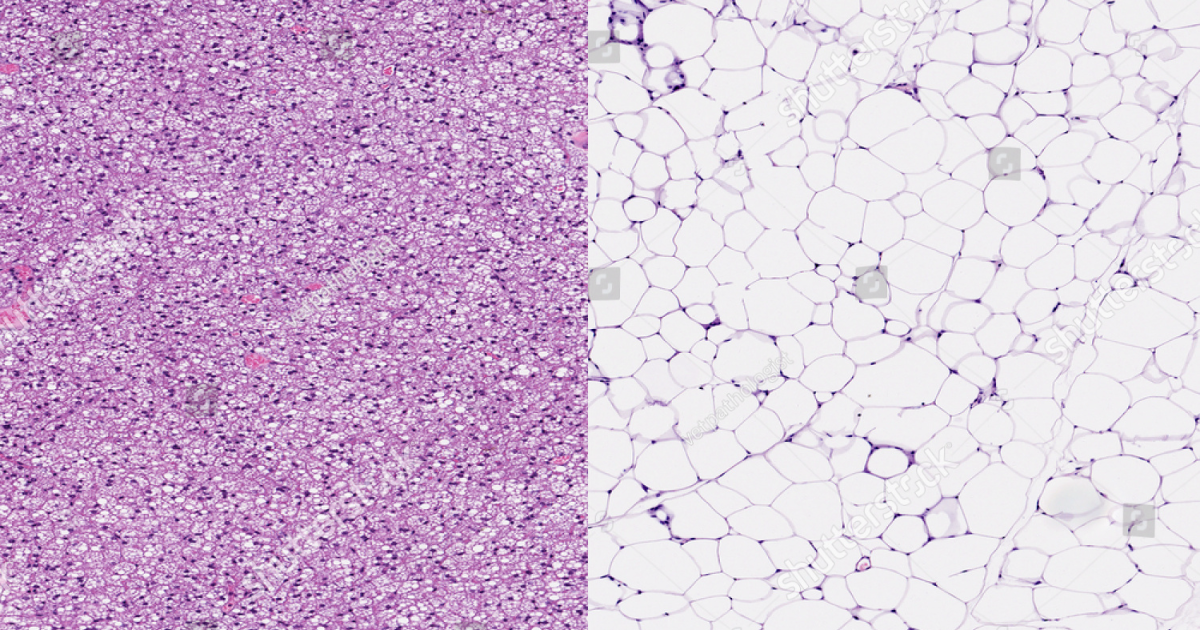 21KETO Gummies: The Science of Lipolysis – What Really Stimulates Fat Release from Adipose Tissue?