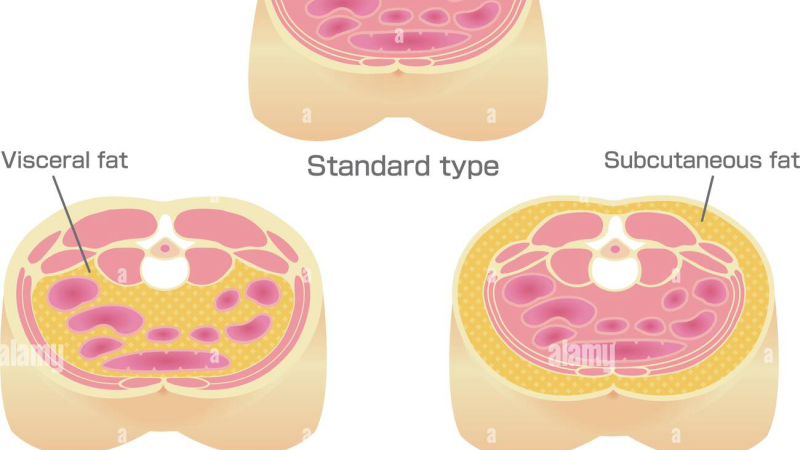 visceral fat vs subcutaneous fat diagram