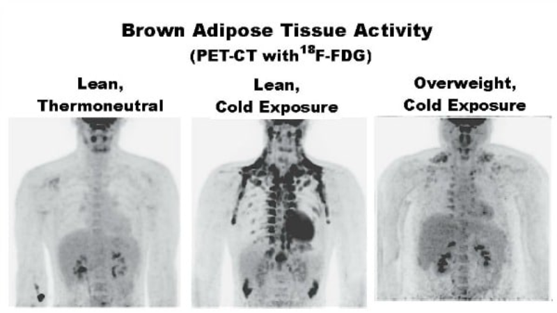 brown adipose tissue thermogenesis illustration