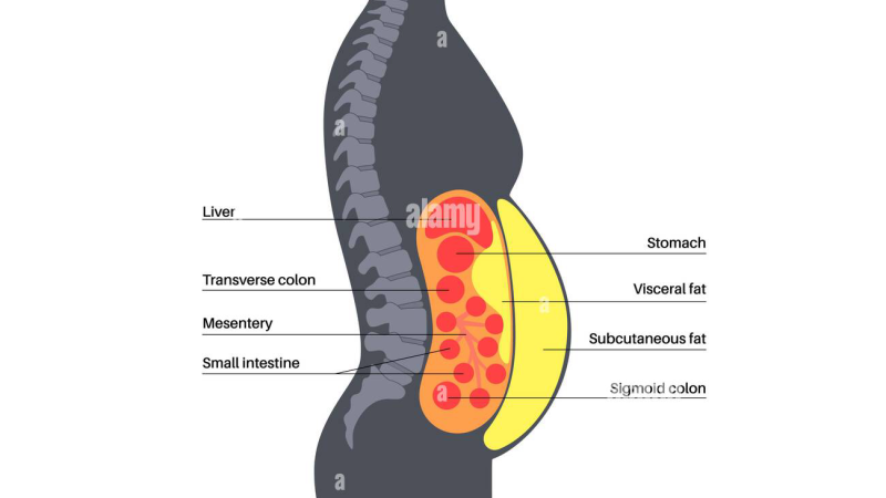 visceral fat illustration showing abdominal organs surrounded by yellow fat